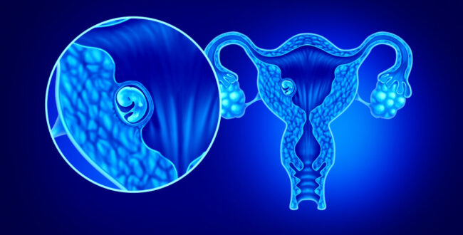 Implanted Embryo In The Uterus