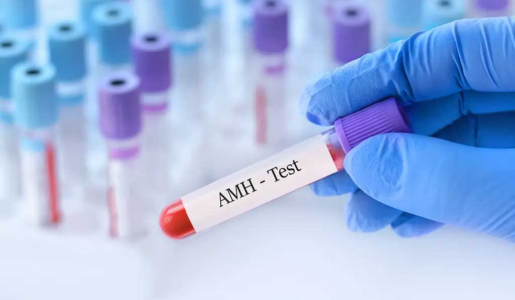 yumurtalik rezerv testi amh fsh